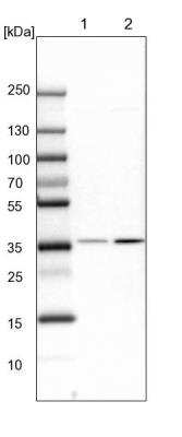 Western Blot: PP2A alpha Antibody [NBP2-46693]