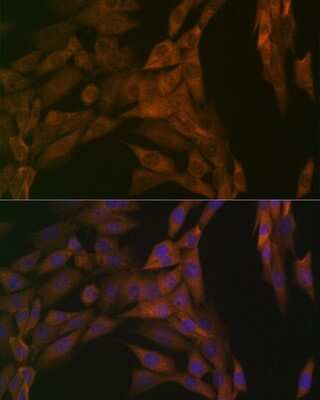 Immunocytochemistry/ Immunofluorescence: PP2A alpha/beta Antibody (4J2Z8) [NBP3-16634]