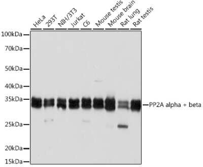 Western Blot: PP2A alpha/beta Antibody (4J2Z8) [NBP3-16634]