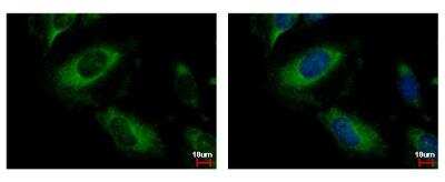Immunocytochemistry/ Immunofluorescence: PP2C alpha/PPM1A Antibody [NBP1-32751]