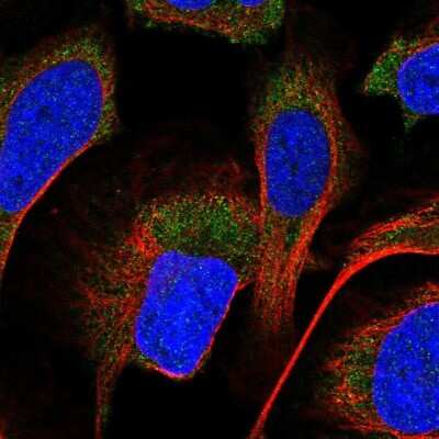 Immunocytochemistry/ Immunofluorescence: PP2C alpha/PPM1A Antibody [NBP2-13796]