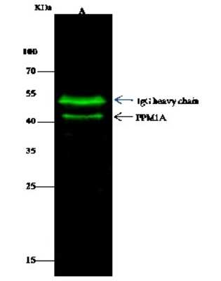 Immunoprecipitation: PP2C alpha/PPM1A Antibody [NBP2-98253]