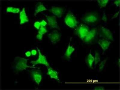 Immunocytochemistry/ Immunofluorescence: PP2C beta/PPM1B Antibody (1A3-2A4) [H00005495-M01]