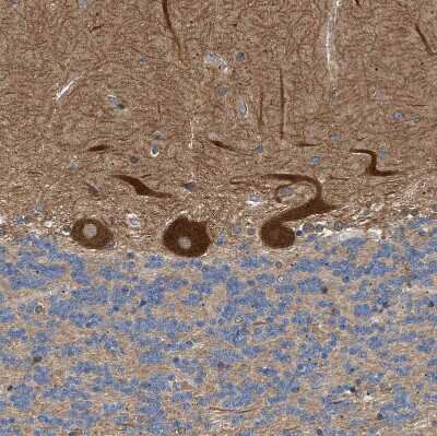 Immunohistochemistry-Paraffin: PP2C beta/PPM1B Antibody [NBP1-87250]
