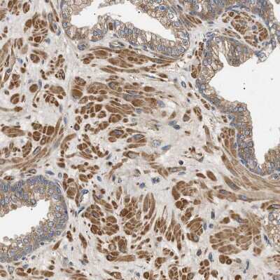 Immunohistochemistry-Paraffin: PP2C beta/PPM1B Antibody [NBP1-87250]