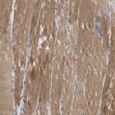 Immunohistochemistry-Paraffin: PP2C beta/PPM1B Antibody [NBP1-87250]