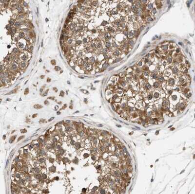 Immunohistochemistry-Paraffin: PP2C beta/PPM1B Antibody [NBP1-87250]