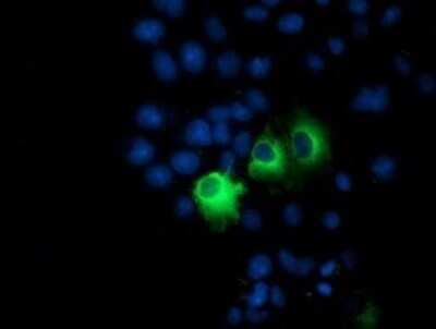 Immunocytochemistry/ Immunofluorescence: PP2C beta/PPM1B Antibody (OTI3C9) - Azide and BSA Free [NBP2-73548]