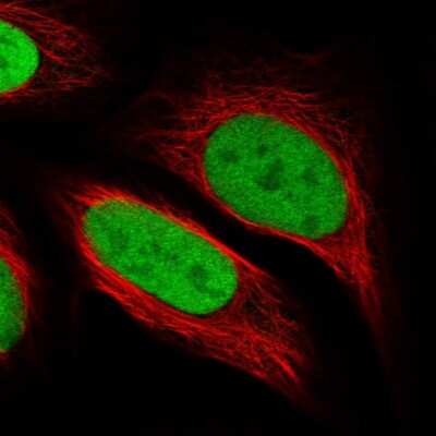 Immunocytochemistry/ Immunofluorescence: PP2C gamma/PPM1G Antibody [NBP1-87245]