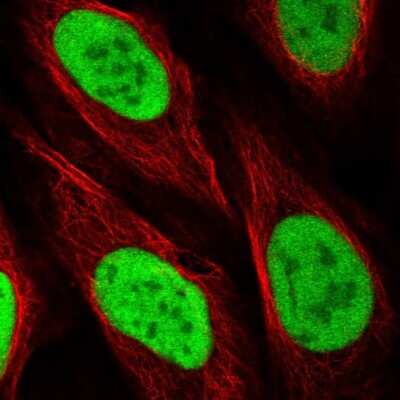 Immunocytochemistry/ Immunofluorescence: PP2C gamma/PPM1G Antibody [NBP1-87246]