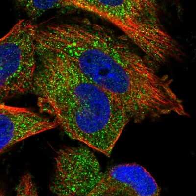 Immunocytochemistry/ Immunofluorescence: PP5 Antibody [NBP1-87240]