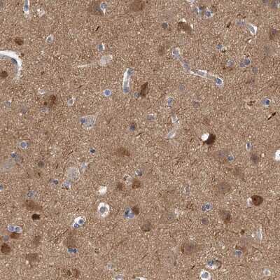 Immunohistochemistry-Paraffin: PP5 Antibody [NBP1-87240]