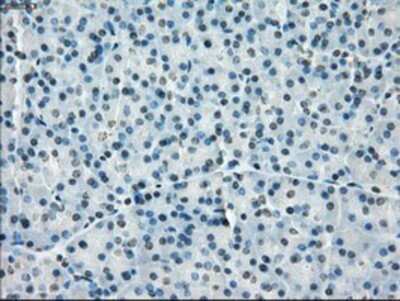 Immunohistochemistry: PP5 Antibody (OTI2E12) - Azide and BSA Free [NBP2-73555]