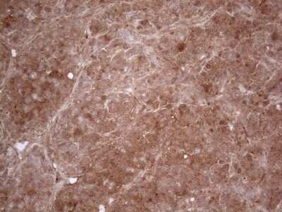 Immunohistochemistry: PPA2 Antibody (OTI7C1) - Azide and BSA Free [NBP2-73563]