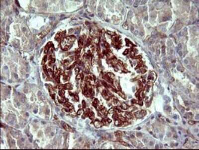 Immunohistochemistry: PPAP2A Antibody (OTI1H4) [NBP2-45378]