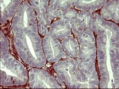 Immunohistochemistry: PPAP2A Antibody (OTI1H4) [NBP2-45378]