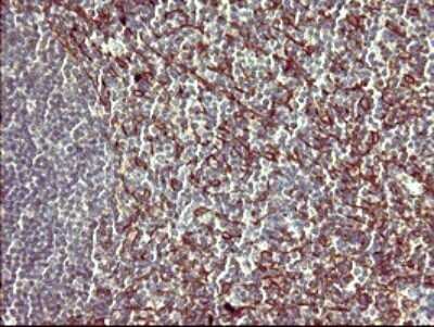 Immunohistochemistry: PPAP2A Antibody (OTI1H4) - Azide and BSA Free [NBP2-73564]