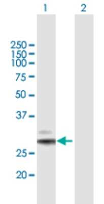 Western Blot: PPAP2A Antibody [H00008611-B01P]