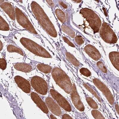 Immunohistochemistry-Paraffin: PPAPDC3 Antibody [NBP2-56028]