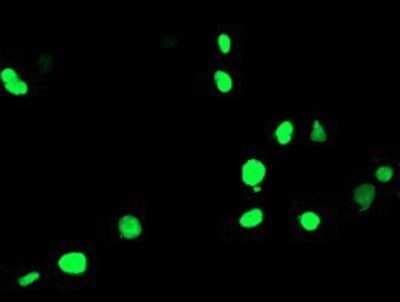 Immunocytochemistry/ Immunofluorescence: PPAR alpha/NR1C1 Antibody (OTI1E8) [NBP2-01211]