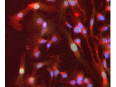 Immunocytochemistry/ Immunofluorescence: PPAR alpha/NR1C1 Antibody - N-terminal [NB600-636]