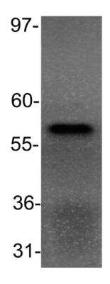 Western Blot: PPAR alpha/NR1C1 Antibody (3B6/PPAR)BSA Free [NB300-537]