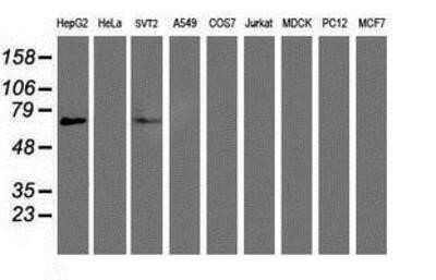 Western Blot: PPAR alpha/NR1C1 Antibody (OTI1E8)Azide and BSA Free [NBP2-73567]