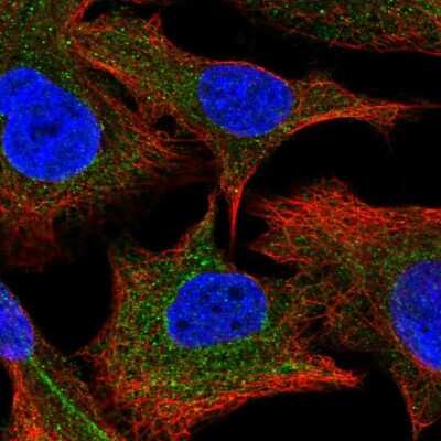 Immunocytochemistry/ Immunofluorescence: PPCDC Antibody [NBP2-13792]