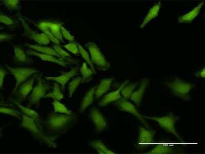 Immunocytochemistry/ Immunofluorescence: PPEF1 Antibody [H00005475-D01P]