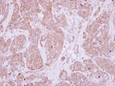 Immunohistochemistry-Paraffin: PPEF1 Antibody [NBP2-19897]