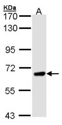 Western Blot: PPEF1 Antibody [NBP1-32103]