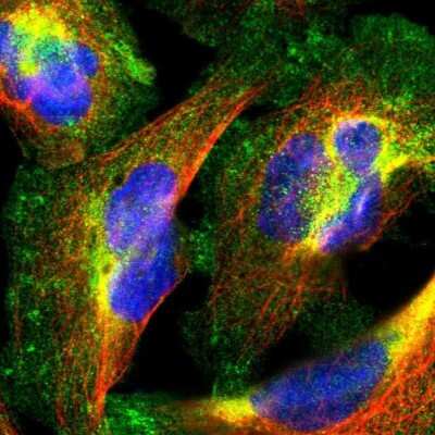 Immunocytochemistry/ Immunofluorescence: PPFIBP1 Antibody [NBP1-83192]