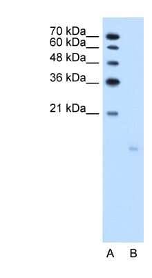 Western Blot: PPFIBP1 Antibody [NBP1-56315]