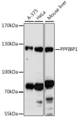 Western Blot: PPFIBP1 AntibodyAzide and BSA Free [NBP2-95188]
