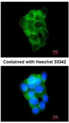 Immunocytochemistry/ Immunofluorescence: PPFIBP2 Antibody [NBP1-33421]