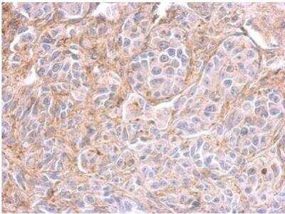 Immunohistochemistry-Paraffin: PPFIBP2 Antibody [NBP1-33421]