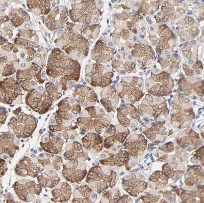 Immunohistochemistry-Paraffin: PPFIBP2 Antibody [NBP1-86575]