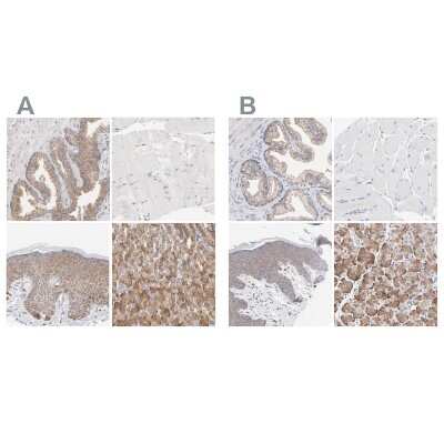 Immunohistochemistry-Paraffin: PPFIBP2 Antibody [NBP1-86576]