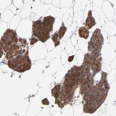 Immunohistochemistry-Paraffin: PPFIBP2 Antibody [NBP1-86576]