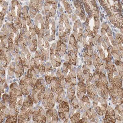 Immunohistochemistry-Paraffin: PPFIBP2 Antibody [NBP1-86576]