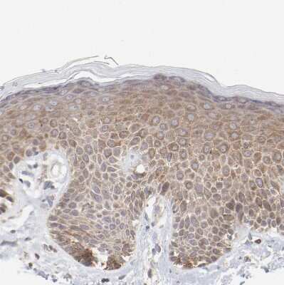 Immunohistochemistry-Paraffin: PPFIBP2 Antibody [NBP1-86576]