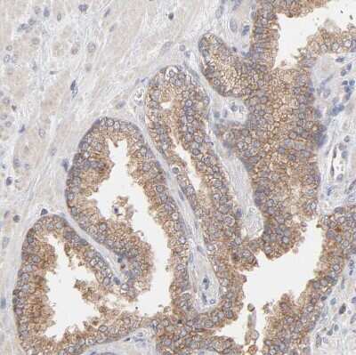 Immunohistochemistry-Paraffin: PPFIBP2 Antibody [NBP1-86576]