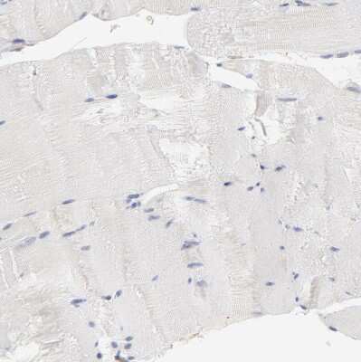 Immunohistochemistry-Paraffin: PPFIBP2 Antibody [NBP1-86576]