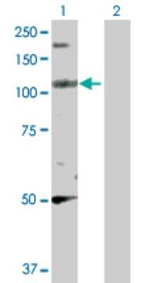 Western Blot: PPFIBP2 Antibody [H00008495-D01P]