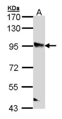 Western Blot: PPFIBP2 Antibody [NBP1-33421]
