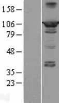 Western Blot: PPFIBP2 Overexpression Lysate [NBL1-14643]