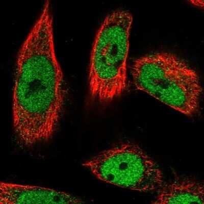 Immunocytochemistry/ Immunofluorescence: PPHLN1 Antibody [NBP1-89480]