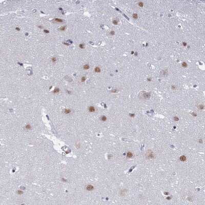 Immunohistochemistry-Paraffin: PPHLN1 Antibody [NBP1-89480]