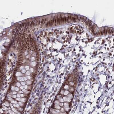 Immunohistochemistry-Paraffin: PPHLN1 Antibody [NBP1-89480]
