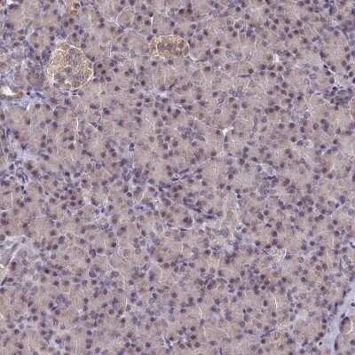 Immunohistochemistry-Paraffin: PPHLN1 Antibody [NBP1-89480]
